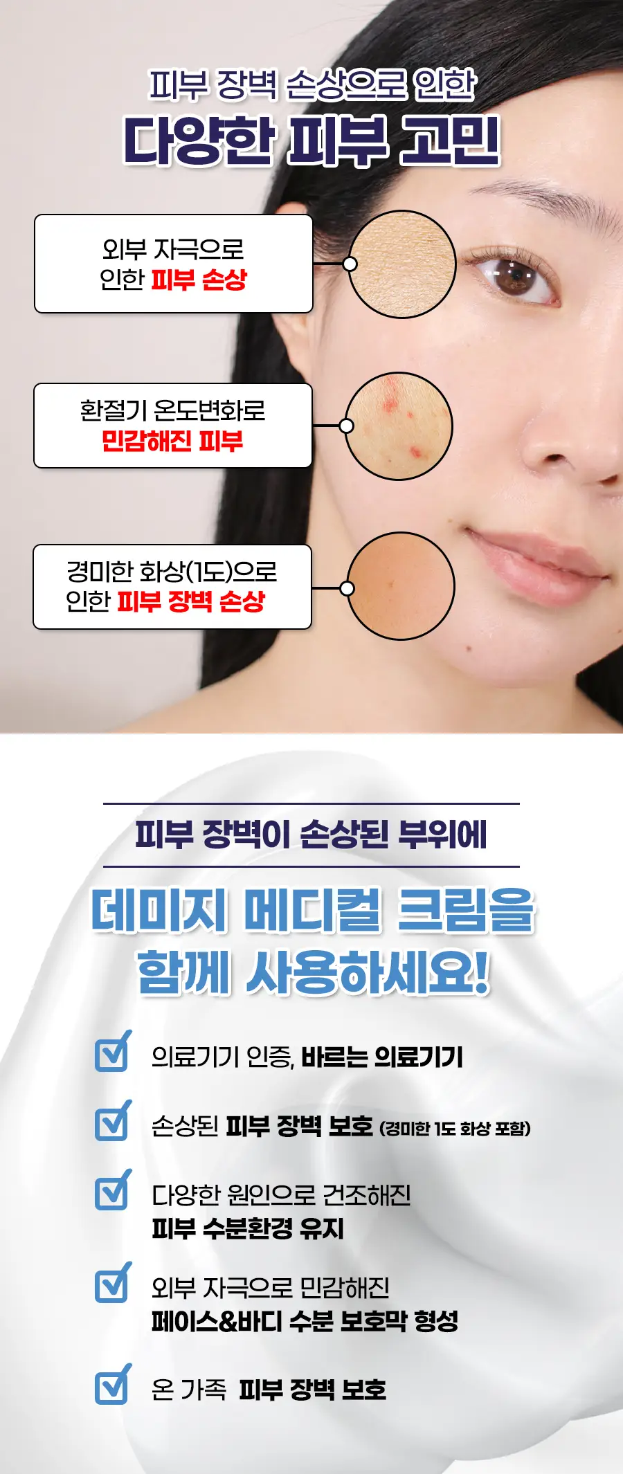 [의료기기] 케어플러스 데미지 메디컬 크림 40g 상세페이지 3